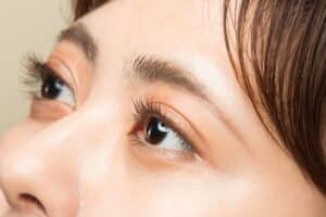 Blepharoplasty