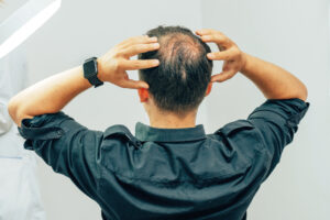 A man with a bald spot on the back of his head standing with his back to the camera